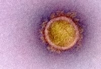 Das SARS-Coronavirus 2 unter dem Elektronenmikroskop