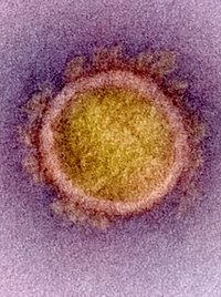 Das SARS-Coronavirus 2 unter dem Elektronenmikroskop